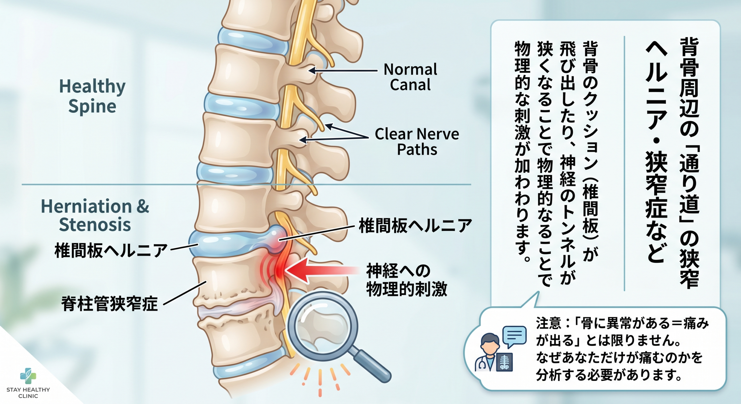 宇都宮整体MOVE lab 症状改善イメージ